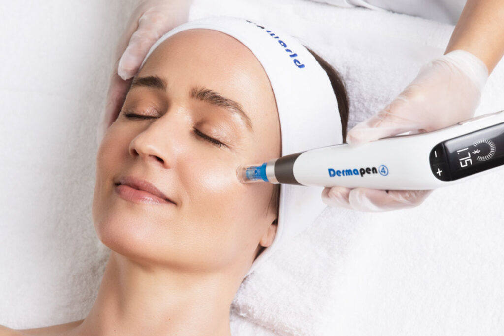 Titelbild zu „Die Vorteile von Microneedling für die Haut“